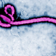 Illustration for article titled What You Need To Know About Ebola